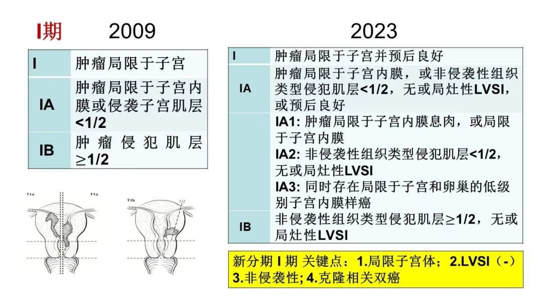 子宮內(nèi)膜癌最新分期，探索隱秘寶藏的分期之旅